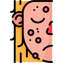 喝牛奶易長痘痘的人適合喝植物奶